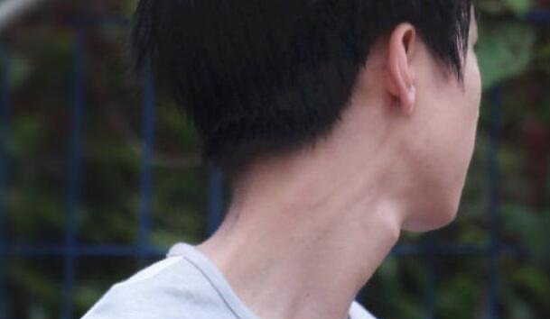 网络配图 网络配图